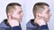 Before and after. On the left, the man indicates ear pain, and on the right, indicates that the ear no longer hurts. Pain manageme