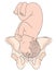 Left Occiput Transverse LOT Baby Fetal Position Pelvis ROT Right