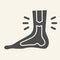 Leg ankle pain solid icon. Foot joint bones injury glyph style pictogram on white background. Injury leg for mobile