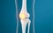 Leg bone and knee lesions, 3d rendering
