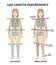 Leg length discrepancy condition with imbalanced skeleton outline diagram