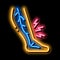 leg pain varicose disease neon glow icon illustration