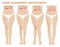 Legs and angles of the knees, different types of leg shapes. Normal varus and valgus