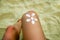 Legs of a girl lying on a beach deckchair by the sea. The sun, painted on sunburnt skin of the foot with sunscreen