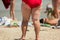 Legs of obese woman.