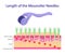 Length of the mesoroller needles, Vector illustration