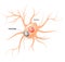 Lewy body. Parkinsons disease and Alzheimers disease