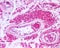 Leydig cells. Klinefelter syndrome