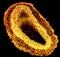 Light micrograph of a muscular artery
