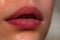 Lip balm. Lipcare lipstick. Close-up of sexy lips. Gloss makeup. Filler Injections, Plastic Surgery, Collagen and