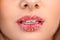 Lip Care. Closeup Of Beautiful Woman Lips With Sugar Lip Scrub