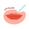 Lip filler plumping augmentation with beauty injection
