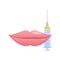 Lip plumping augmentation with filler injection illustration