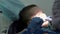 A little boy with damaged baby teeth having a treatment in the dentistry. close-up.