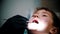 A little boy with damaged baby teeth having a treatment in modern dentistry - the dental