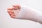 Little girl with a broken arm, a little girl\'s arm bandaged