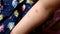 Little girl with chickenpox,