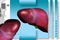 Liver