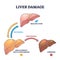 Liver damage stages with reversible and irreversible disease outline concept