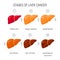 Liver damage vector concept