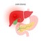 Liver disease concept