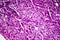 Liver edema, light micrograph