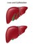 Liver and gallbladder, textbook accuracy