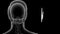 Location of Septal Cartilage in Human