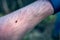 Lone star tick crawling through arm hair on human skin