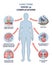 Long term COVID 19 complications with medical symptoms outline diagram