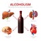 Long-term effects of alcohol. Alcoholism vector