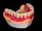 Lower denture
