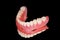 Lower denture