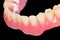 Lower denture