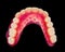 Lower denture