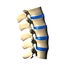 Lumbar Spine - Lateral view