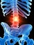 The lumbar spine showing pain