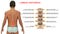 Lumbar vertebrae or lumbar spine