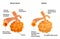 Lung alveoli normal and asthma