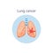 Lung cancer - human pulmonary anatomy graphic with damage sign inside lungs.