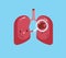 Lung find out lung cancer, disease of lung, cartoon