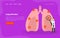 Lung Infection Landing Page Template, Pulmonary Respiratory Medicine, Doctors Analyzing Human Lungs Vector Illustration