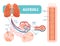 Lungs alveoli schematic, anatomical vector illustration diagram with capillary network.