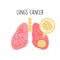 Lungs Cancer flat vector illustration.