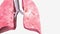 Lungs Coronal Cross Section Left inferior lobe