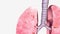 Lungs Coronal Cross Section Right superior lobe