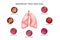 Lungs and respiratory tract infections