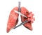 Lungs surgery concept, 3D rendering