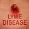 Lyme Disease Concept