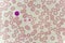 Lymphocyte cell in blood smear